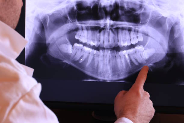Best Emergency TMJ Treatment in Fort Rucker, AL
