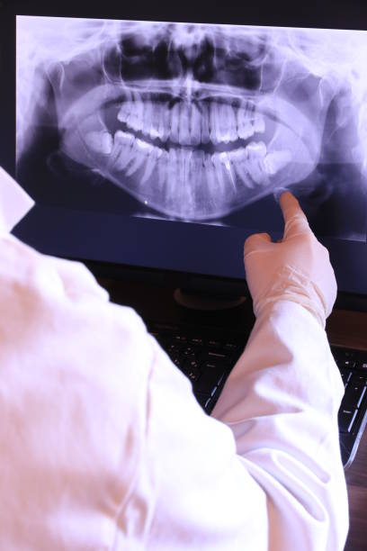 Best Emergency Dental Care for Broken or Chipped Teeth in Fort Rucker, AL