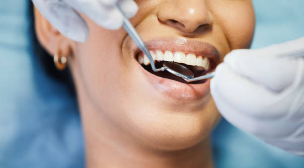 Best Emergency Treatment for Dental Infections or Abscesses in Fort Rucker, AL